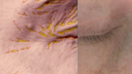 Porovnání před a po aplikaci