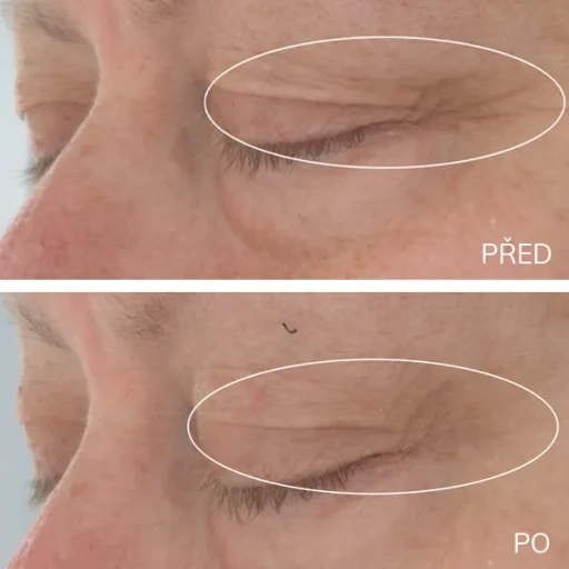 strivectin-Hyaluronic-Tripeptide-Gel-aurio-5-2