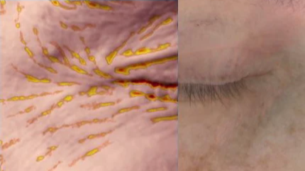 Porovnání před a po aplikaci