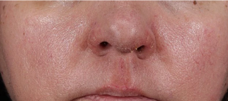 Porovnání před a po aplikaci